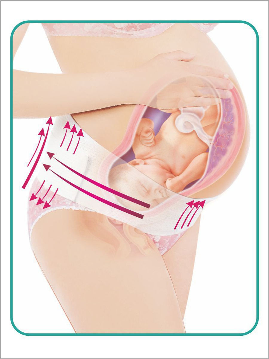 Бандаж для беременных: что, для чего, как и когда его носить?